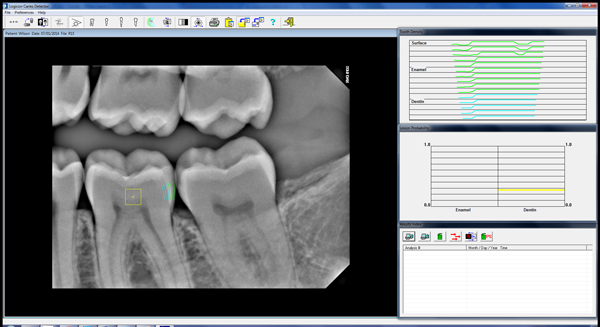 Cavity Scan - After